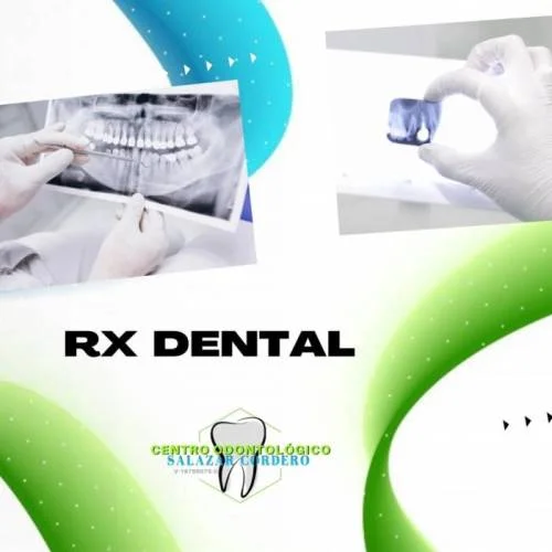 Rayos X  Odontologia