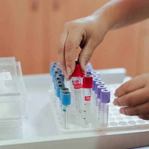 Laboratorio  exámenes de hemoglobina, colesterol e insulina