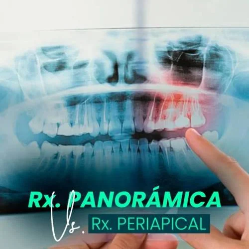 Rayos X  Periapical