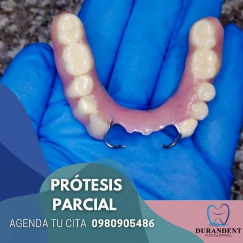 Prótesis Parcial