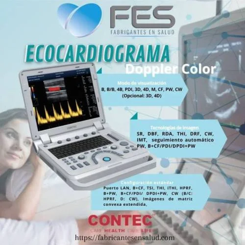 Ecocardiograma