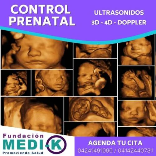Control prenatal