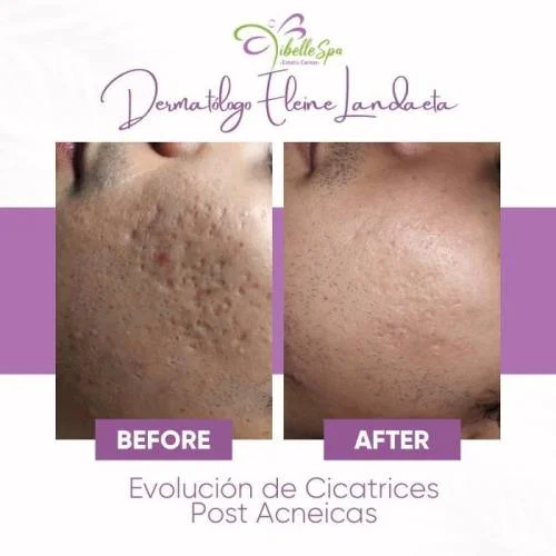 Libelle Spa Estetic Center
