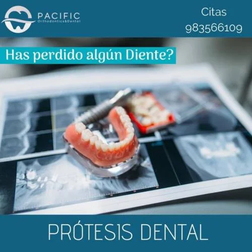Protesis Dental